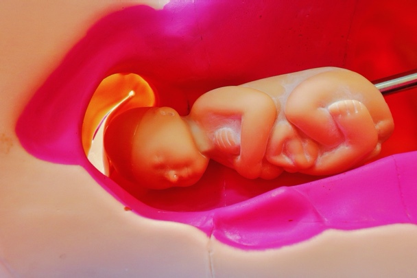 粉色盘子里的热狗
中度可信度描述已自动生成